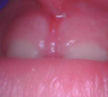 Tiny Trips Pediatric Dentistry | Extractions, Pediatric Dental Emergencies and Exams   Cleanings