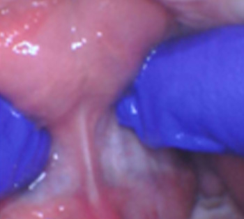 Tiny Trips Pediatric Dentistry | Sleep Dentistry, Exams   Cleanings and Pediatric Dental Emergencies